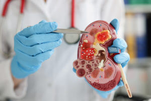 Nephrologist pointing pen kidney structure on anatomical model
