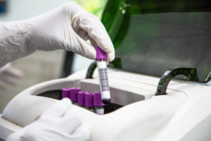 Close-up of gloved hand arranging blood sample with other test tubes for processing in Argentine clinical analysis laboratory.