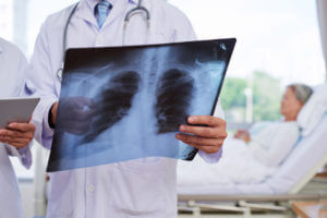 Pulmonary and Critical Care in Syracuse