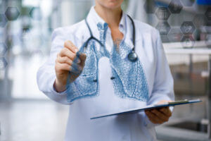 Pulmonologist in Syracuse NY