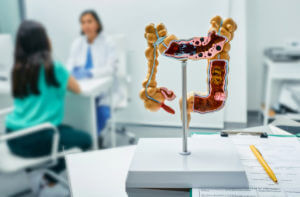 During a gastroenterology consultation, an anatomical model of the intestines is positioned on the doctor's table while a gastroenterologist speaks with a female patient in a medical clinic.
